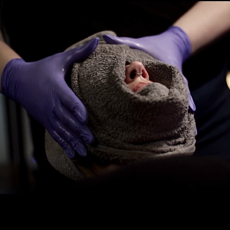 Towel draped around a woman's face with gloved hands on each side of her head CO2 Lift Facial 