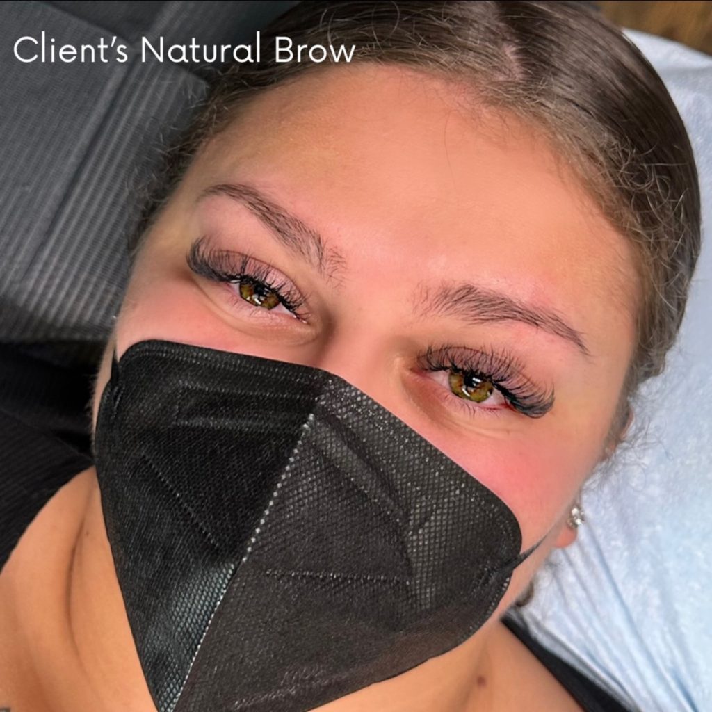 Client's natural brow