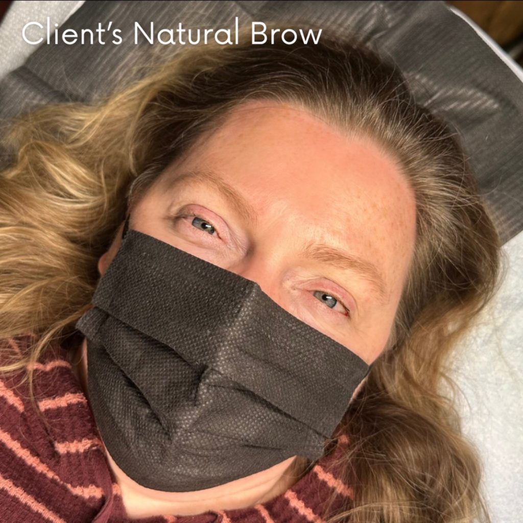 Client's natural brow