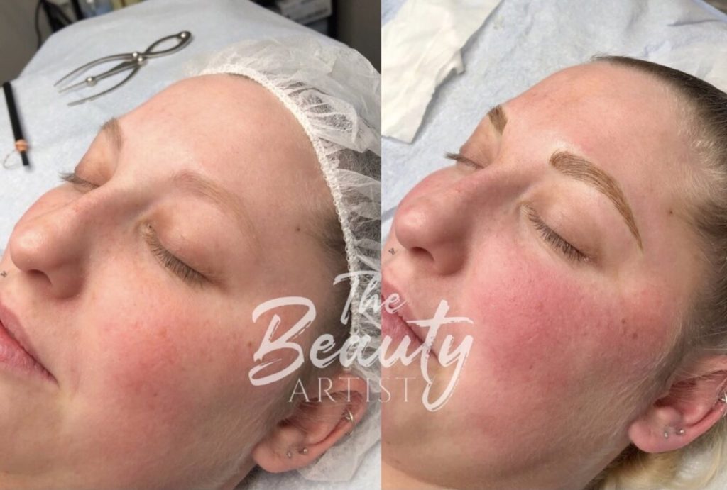 Example of microblading