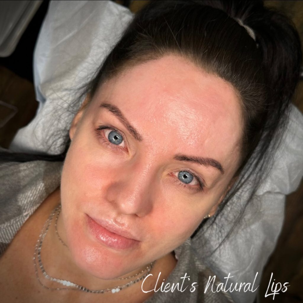 Client's natural lips