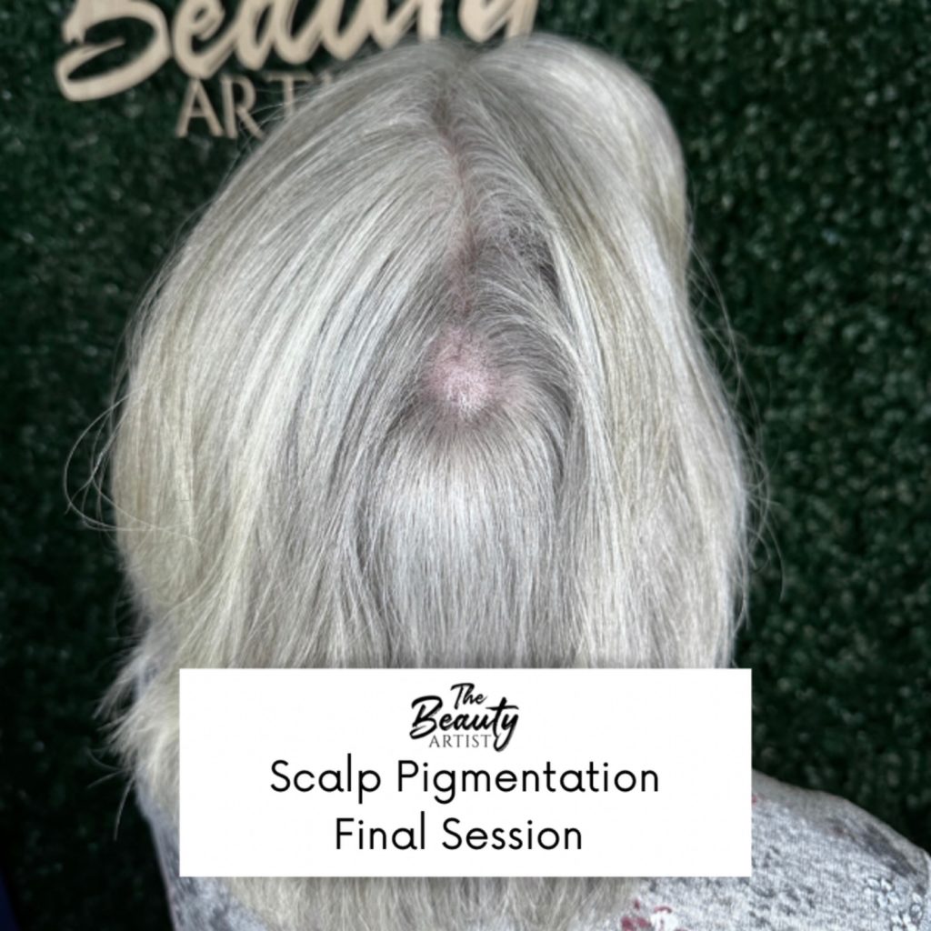 Example of scalp pigmentation final session